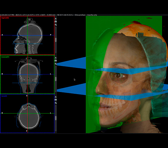 3d-cephalometry-facial-scans.jpg