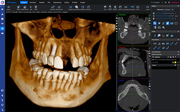menu-romexis-new-3d-rendering-style.jpg
