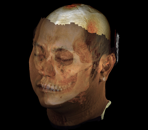 planmeca-proface-virtual-patient.jpg