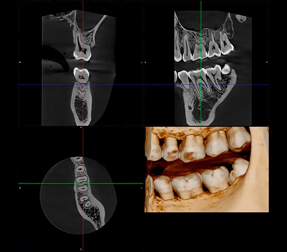 planmeca-viso-g1-endo.jpg