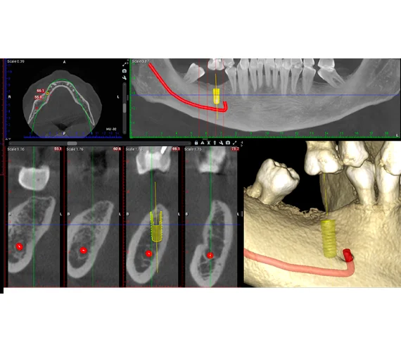 planmeca-viso-g5-clinical-images.jpg