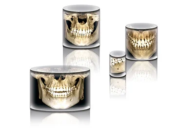ProMax 3D Plus volumes