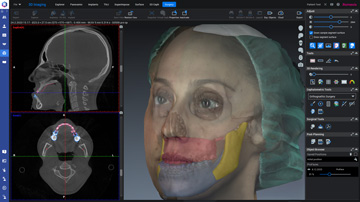 romexis-surgery.jpg