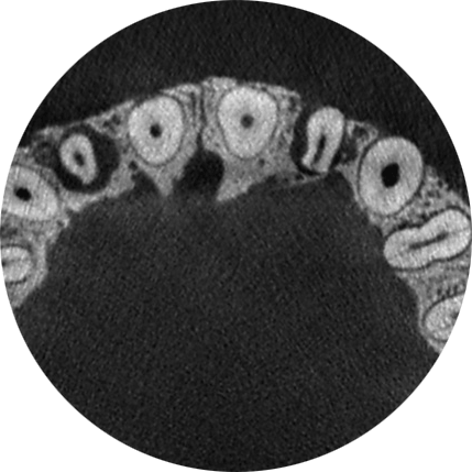 Endodontic imaging mode without AINO