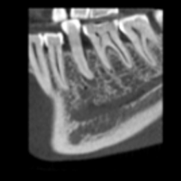 low dose resolution image