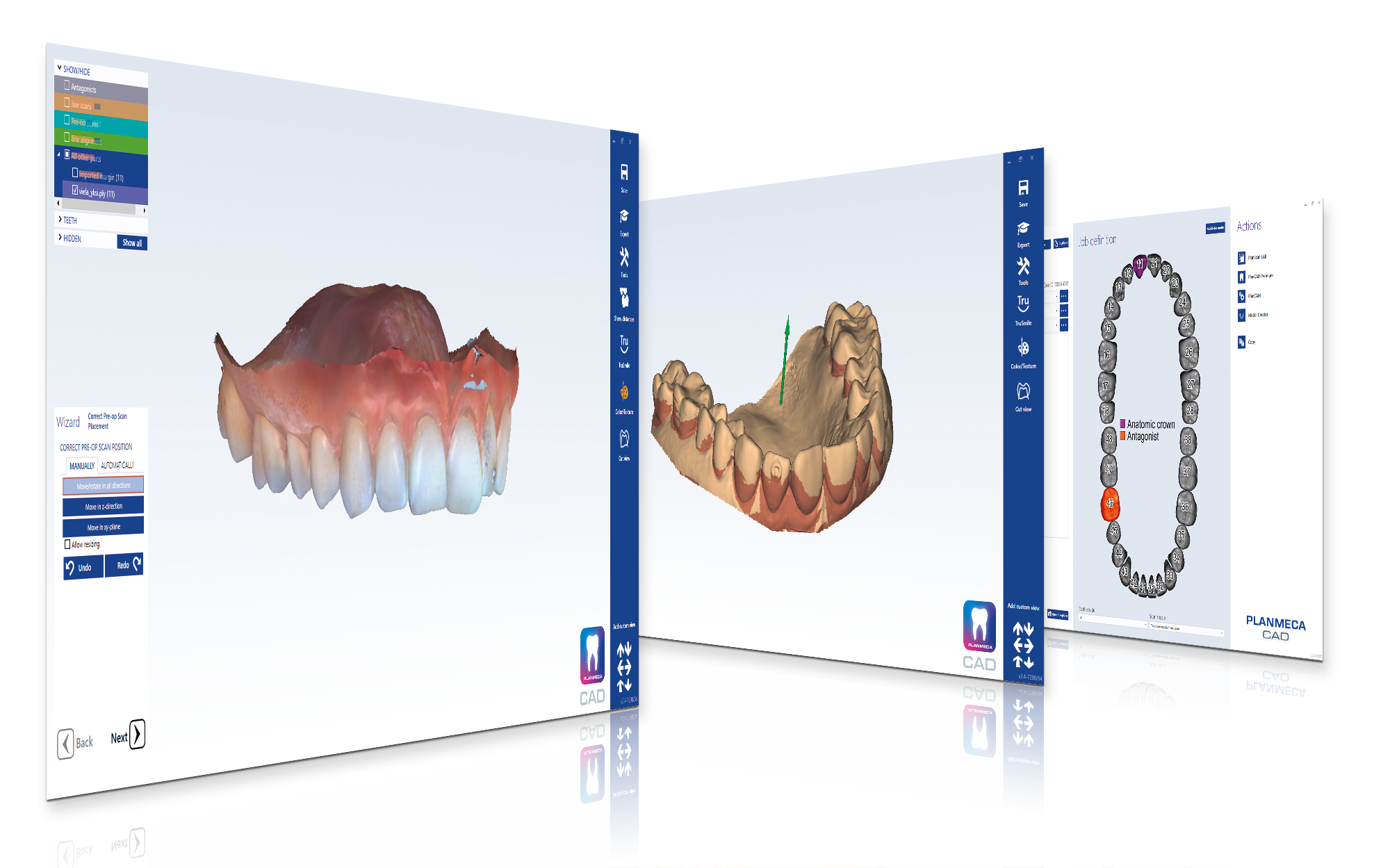 Planmeca PlanCAD Premium software for designing dental prosthetics