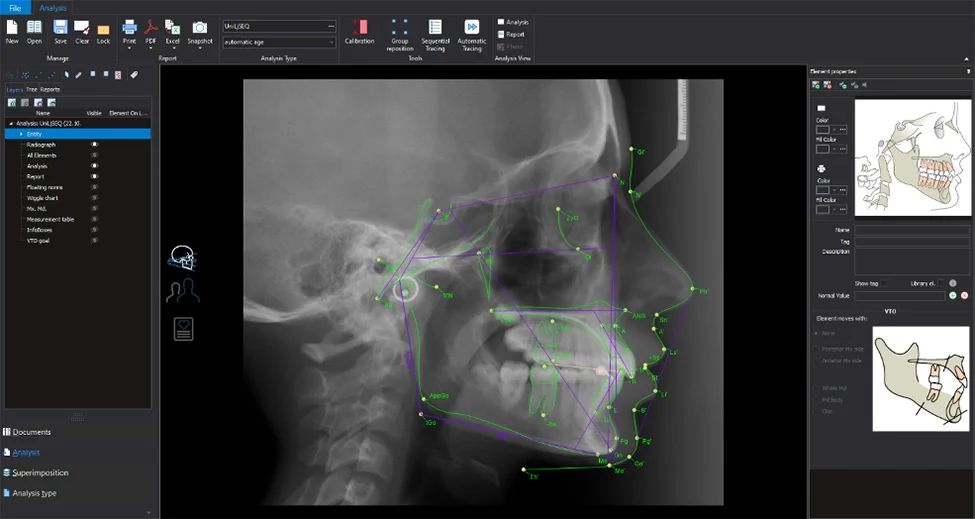 Planmeca Romexis cephalometric analysis software